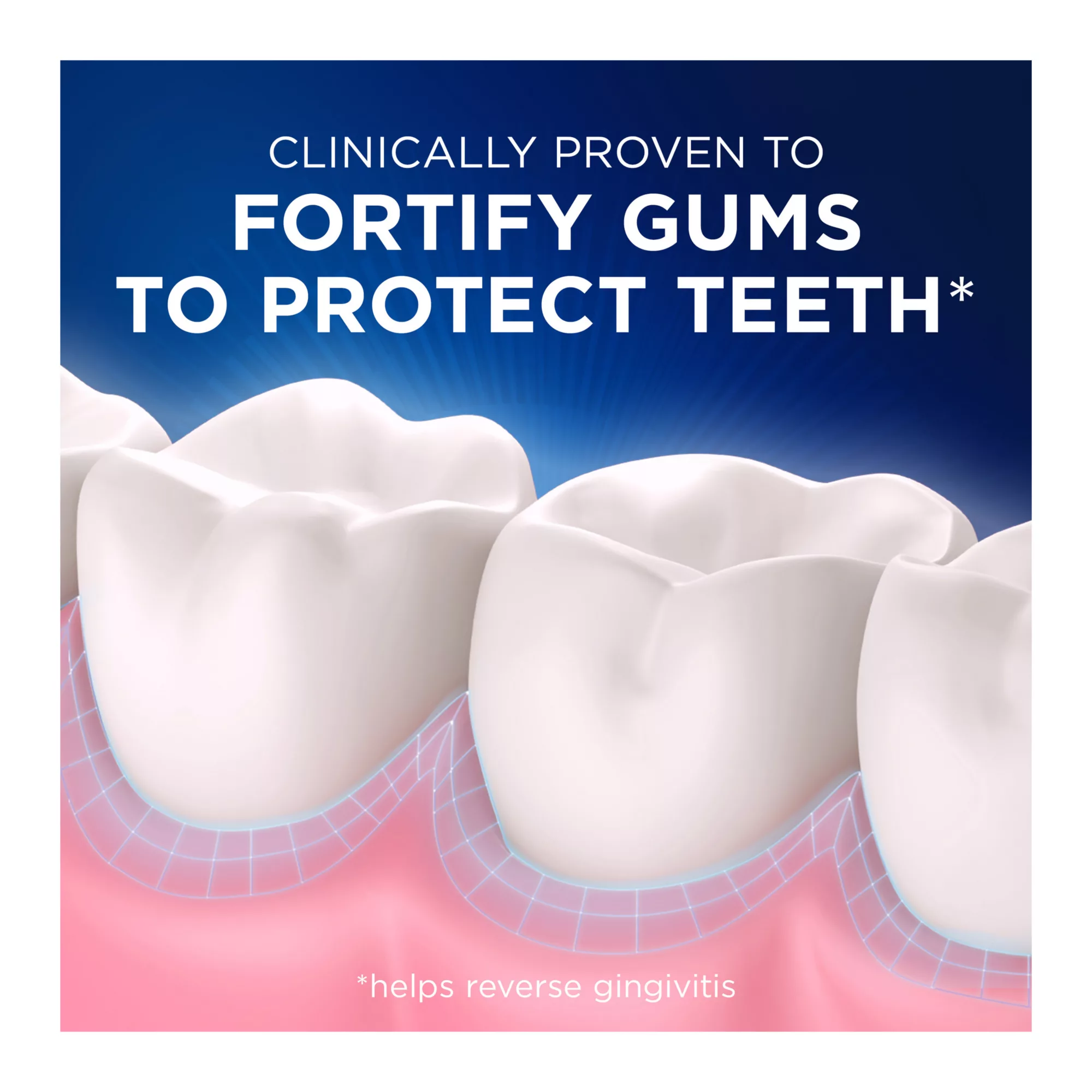 Crest Pro-Health Gum Detoxify Ultra Toothpaste 4.7 Oz (133 G) 4 Pack