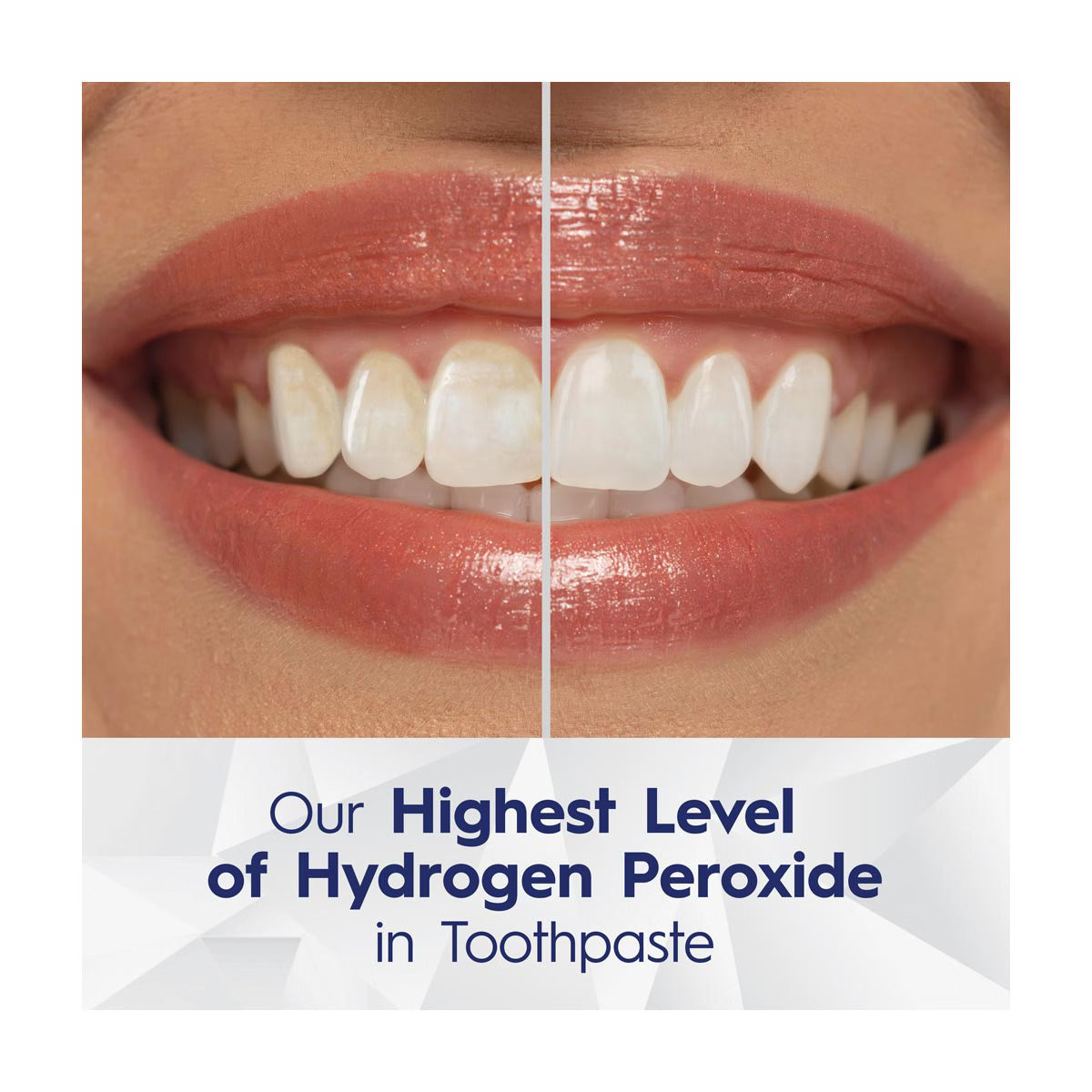 Close-up of a person's mouth with white teeth, showing the effectiveness of hydrogen peroxide in toothpaste.
