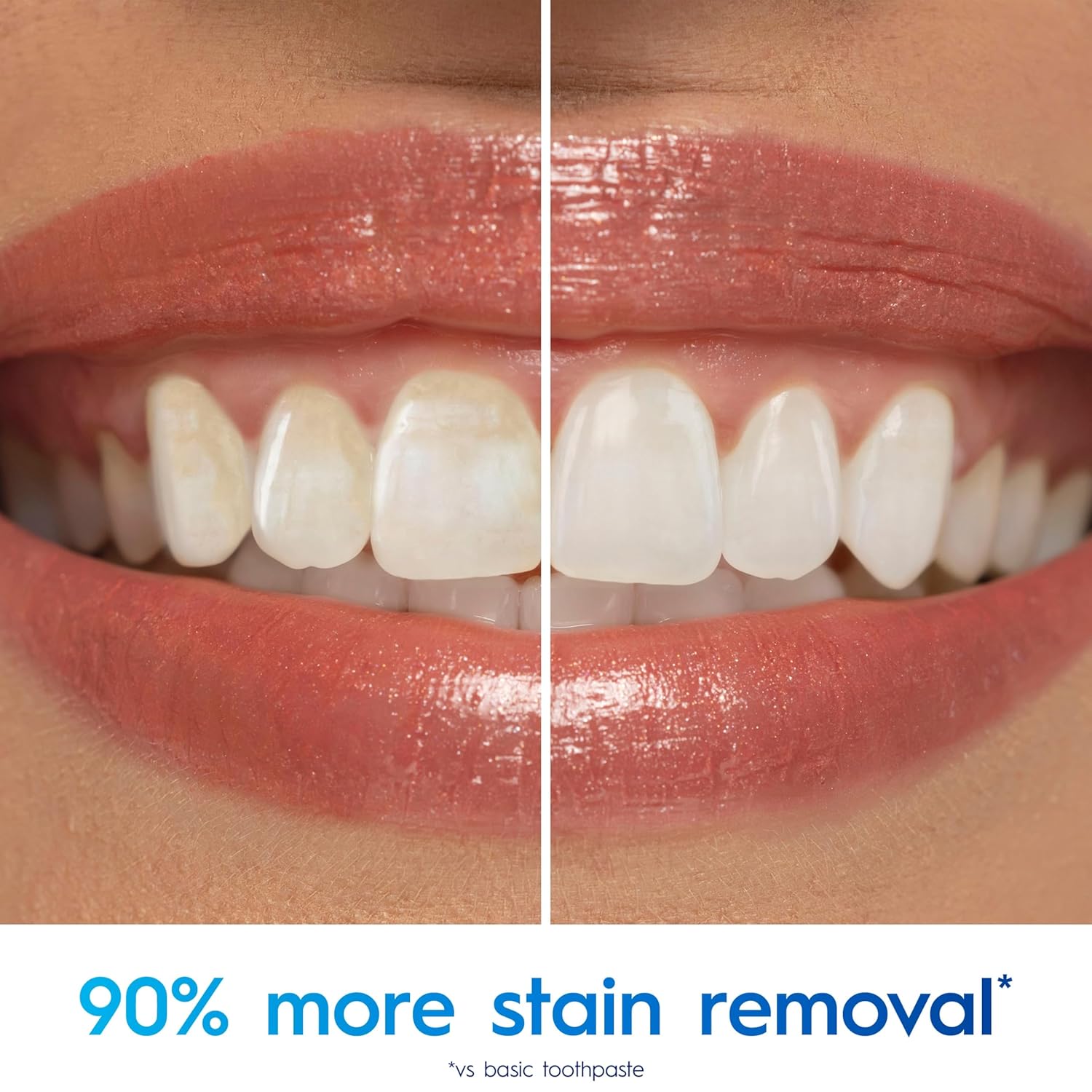 Before and after comparison of teeth with a product claiming 90% more stain removal.