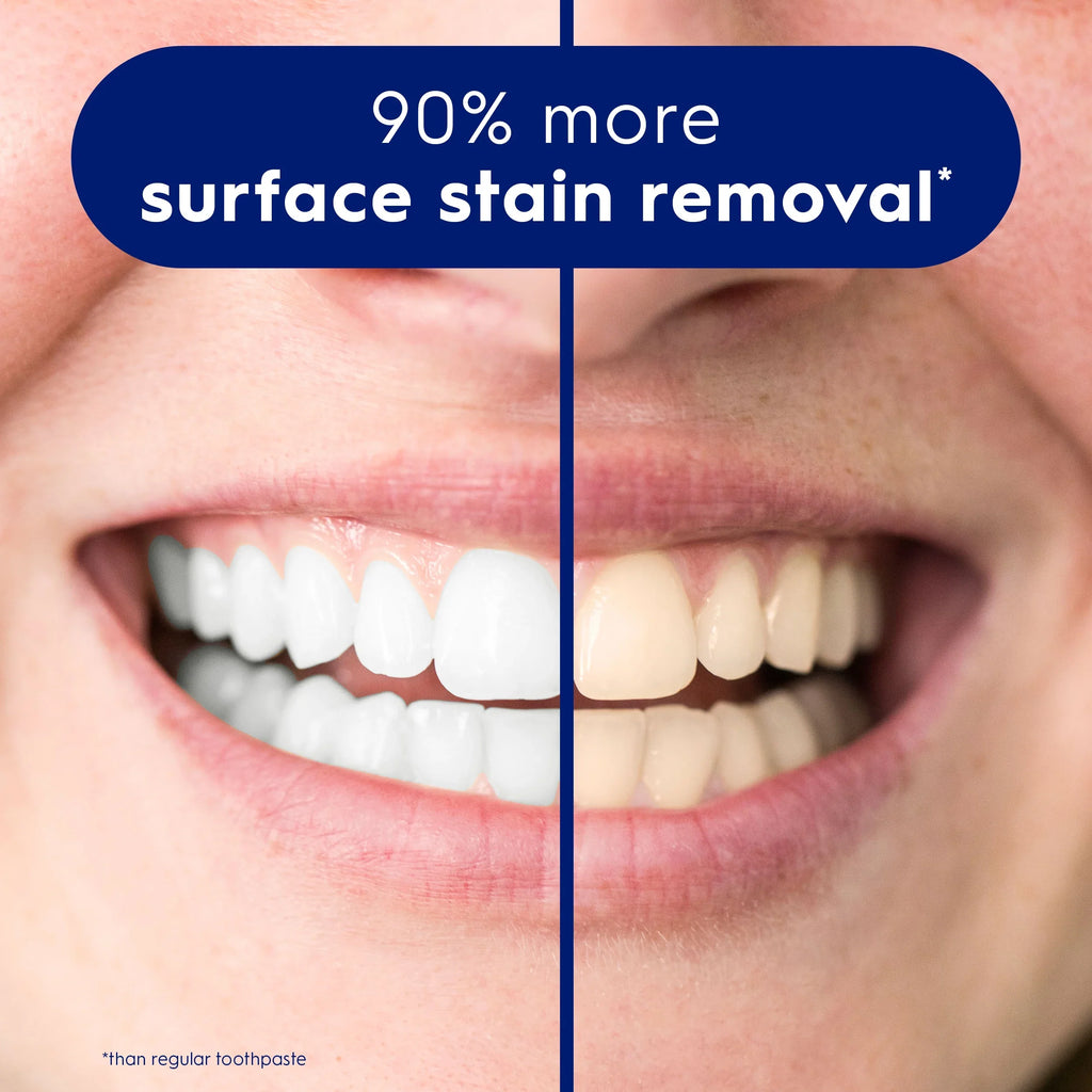 Comparison of teeth with and without surface stain removal, featuring a blue banner with text.