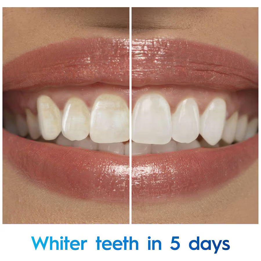 Before and after comparison of teeth whitening with text 'Whiter teeth in 5 days'.
