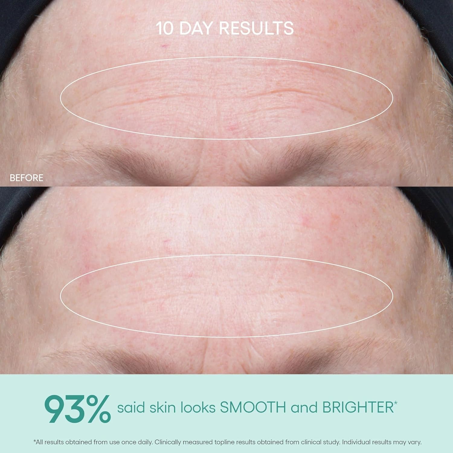 Algenist GENIUS Ultimate Anti-Aging Vitamin C Serum, 1 FL OZ (29 mL)